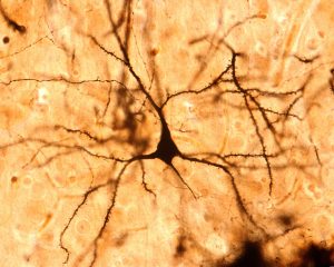 Slide of Brain
