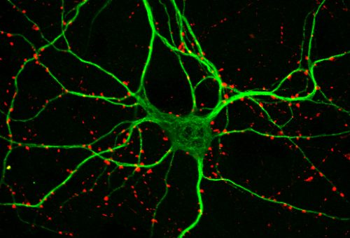 100x-map2-synapsin